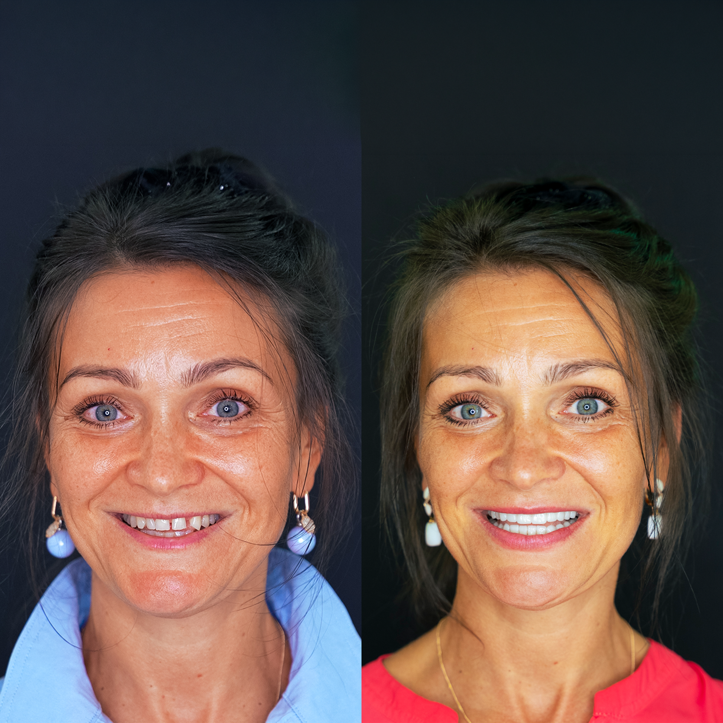 Two women's faces are shown close-up; the woman on the left has gray hair, light skin, and is wearing a blue top, while the woman on the right has dark hair, tan skin, and is wearing a red top.