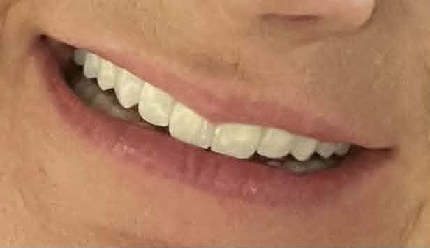 Close-up of a person's smiling mouth showing teeth.